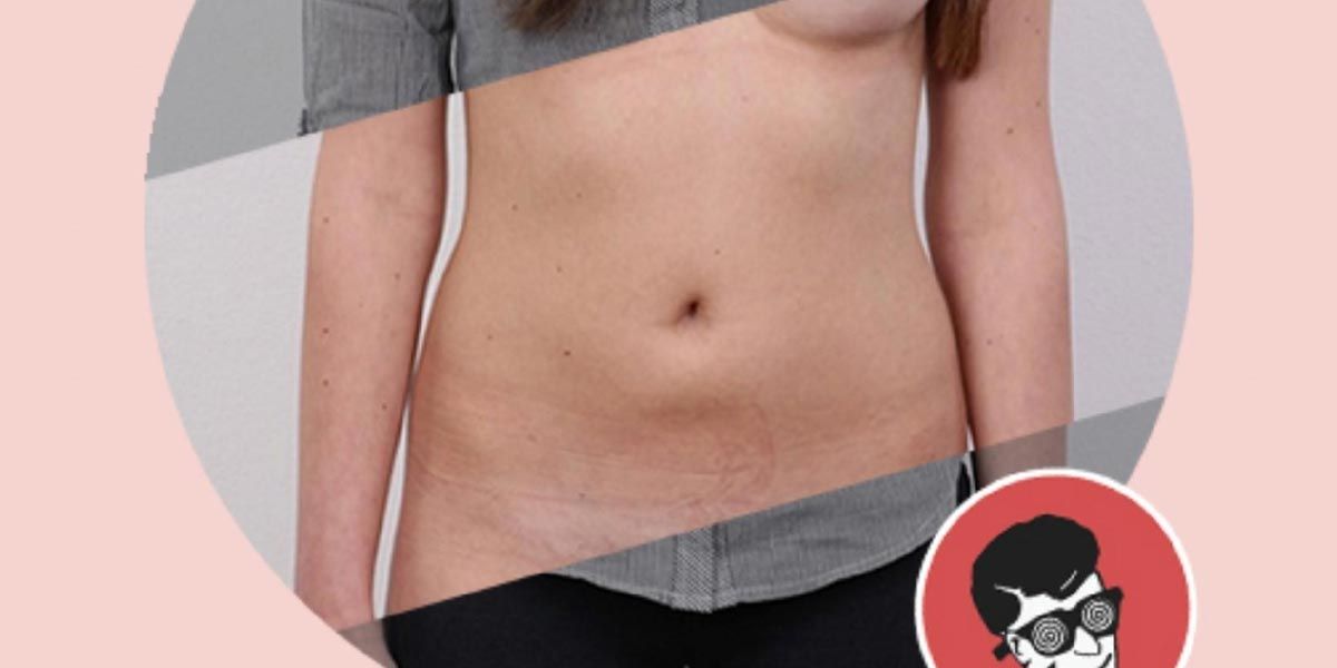 C.U.radoria de Conteúdo: Deepnude.